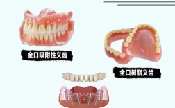 老人镶假牙要注意哪些医学常识？