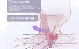 微创的基本常识