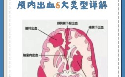 神经外科医学小常识