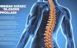 腰间盘突出怎么预防？日常注意什么？