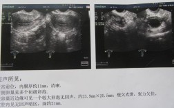 B超图片基本常识，怎么看懂报告？