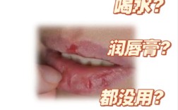 防止嘴唇干裂的小常识
