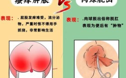 想常识一下肛交