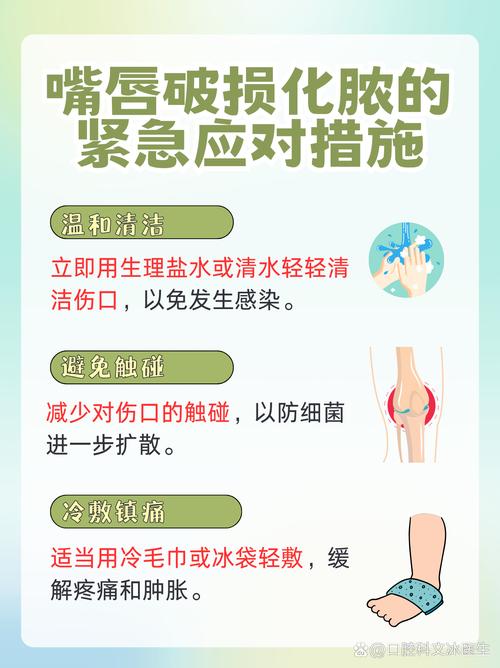 生活中磕了碰了小常识