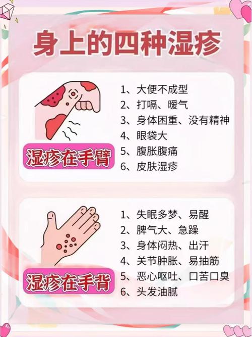 传染性湿疹样皮炎常识