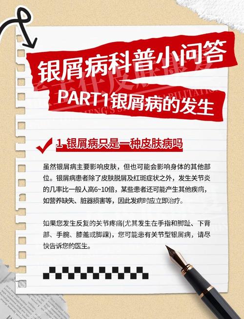 牛皮癣患者生活小常识