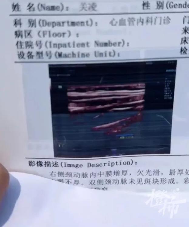 b超斑块的基本小常识