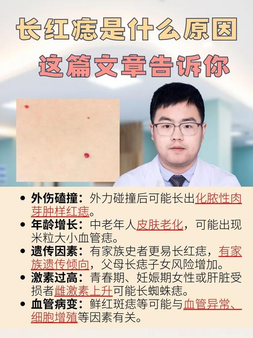 健康小常识身体长红痣