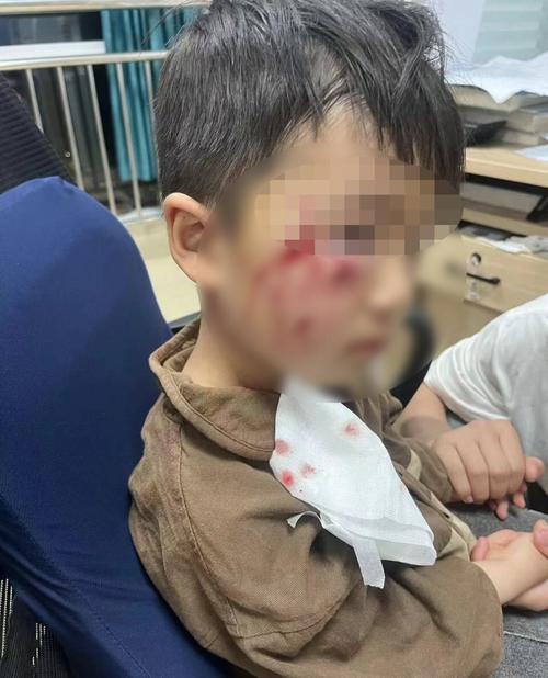 儿童安全教育咬伤