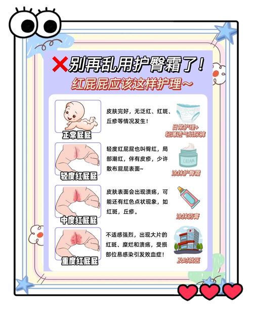 2岁女宝宝屁屁护理常识