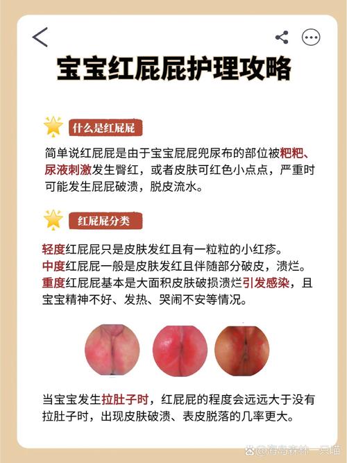 2岁女宝宝屁屁护理常识