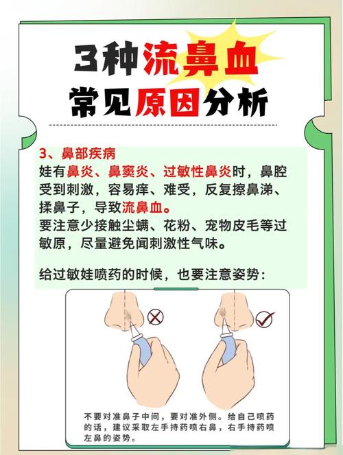 小朋友流鼻血的保健常识