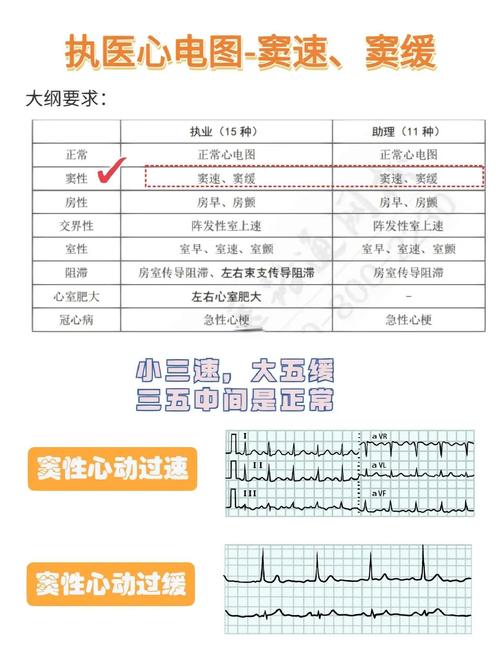 心律失常识别考核标准