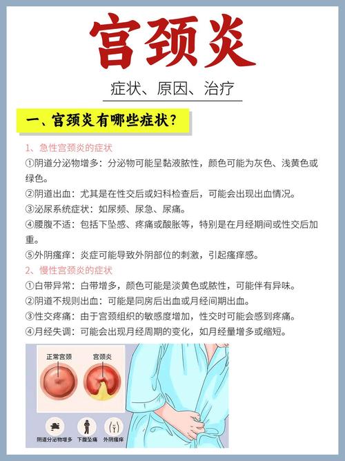 冬季宫颈炎小常识