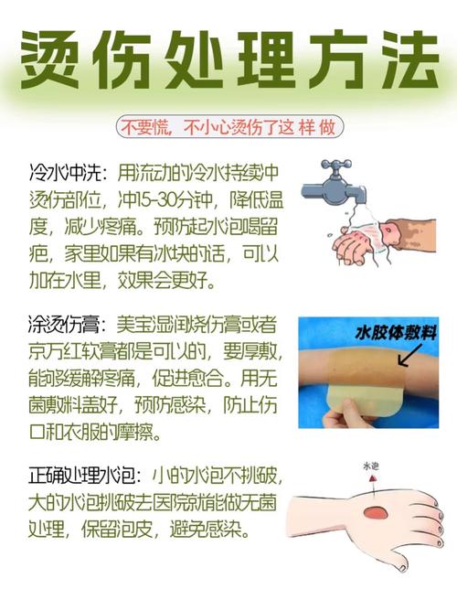 轻微烫伤的临时处理常识
