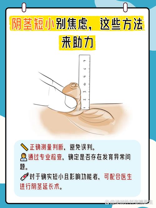 关于男人丁丁的常识