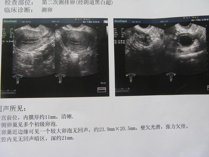 b超图片基本常识