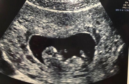 b超图片基本常识