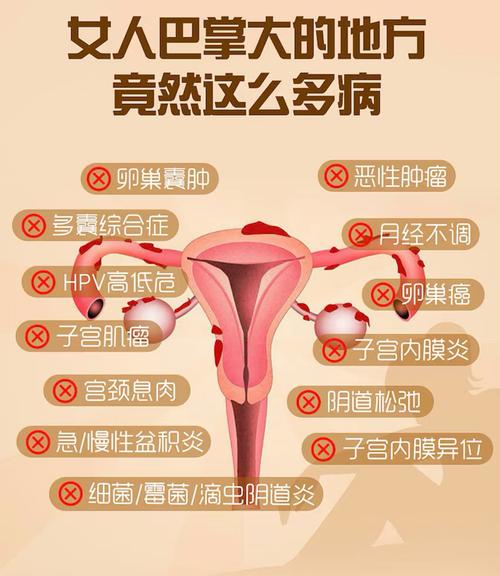 妇科炎症 宣传小常识