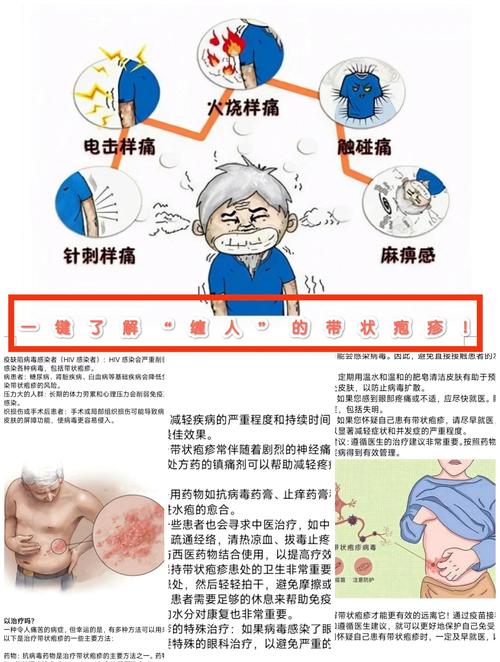 关于带状疱疹的常识
