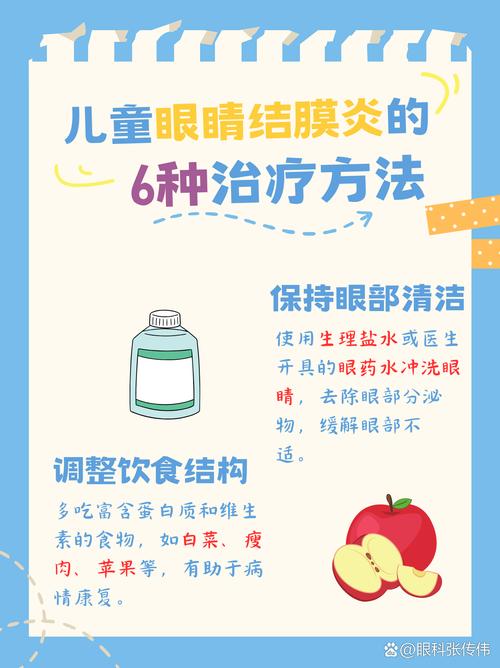 结膜炎预防小常识