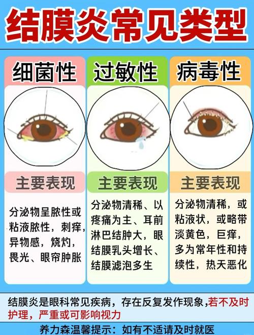 结膜炎预防小常识