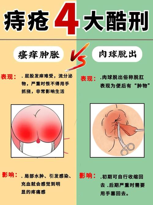 想常识一下肛交