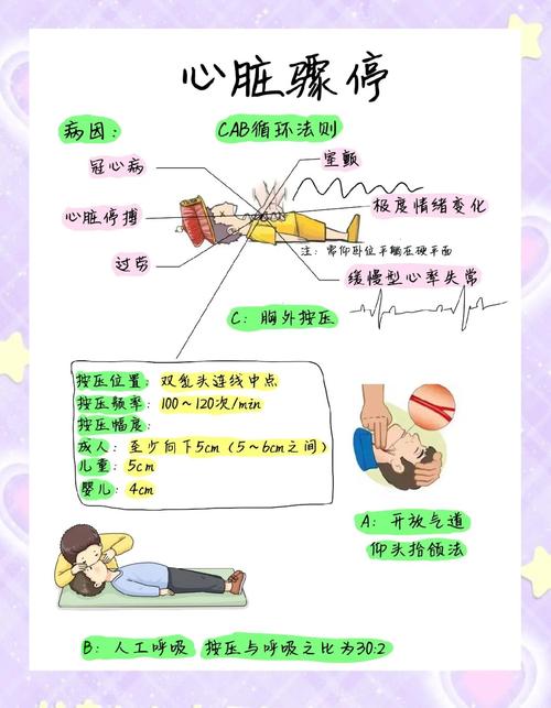 心脏病急救小常识