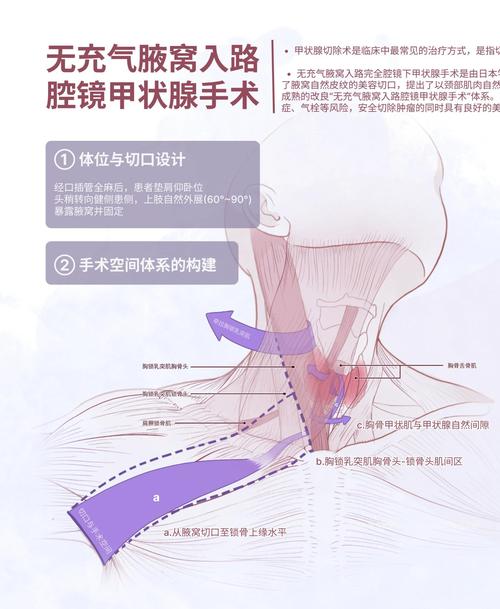 微创的基本常识