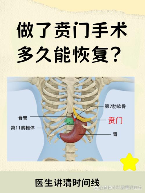 微创的基本常识