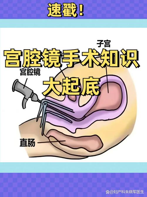 微创的基本常识